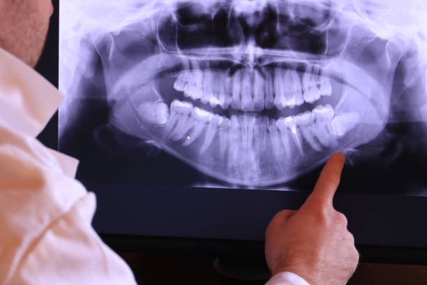 Best Weekend Emergency Dentist in South Miami, FL
