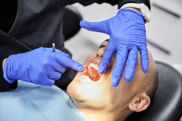 Best Emergency Dentist for Special Needs Patients in South Miami, FL